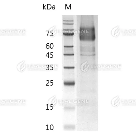 SDS-PAGE analysis of recombinant Human PDGFR Alpha.
