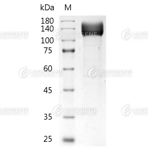 Human VEGFR2, His Tag, HEK293