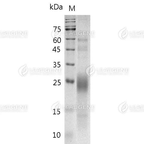 Mouse QA-2, Alpha 1 domain, His Tag, CHO