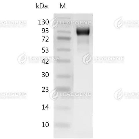 SDS-PAGE analysis of recombinant human EGFR protein.
