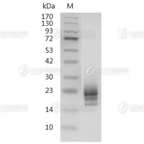 SDS-PAGE analysis of recombinant Human CD63.