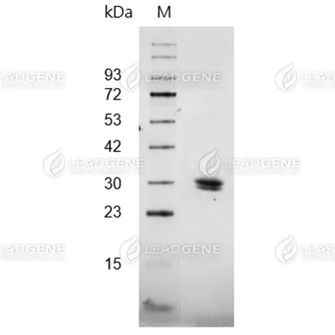 Human KLK2, His Tag, CHO