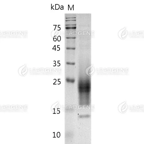 Human CD300A, His Tag, CHO