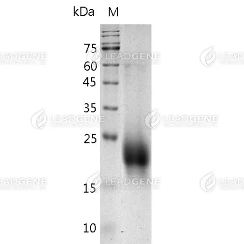 Human CTLA-4, His Tag, CHO