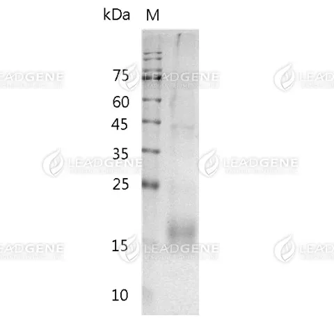 SDS-PAGE analysis of recombinant human TIGIT.