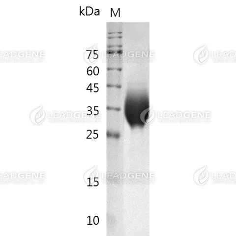 SDS-PAGE analysis of recombinant Human CD276.