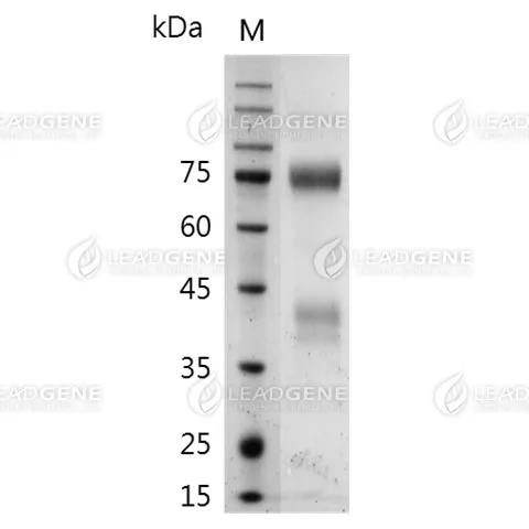 SDS-PAGE analysis of recombinant Mouse cMet.
