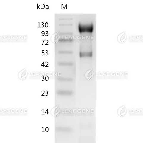 SDS-PAGE analysis of recombinant Human P-selectin.