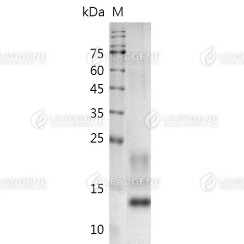 Mouse Alpha Lactalbumin, His Tag, CHO