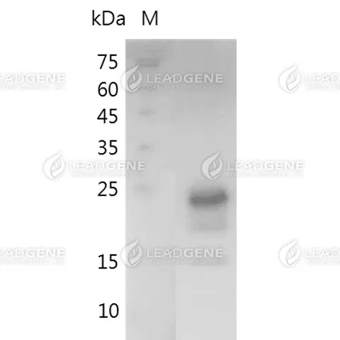 SDS-PAGE analysis of recombinant Human IFN Gamma.