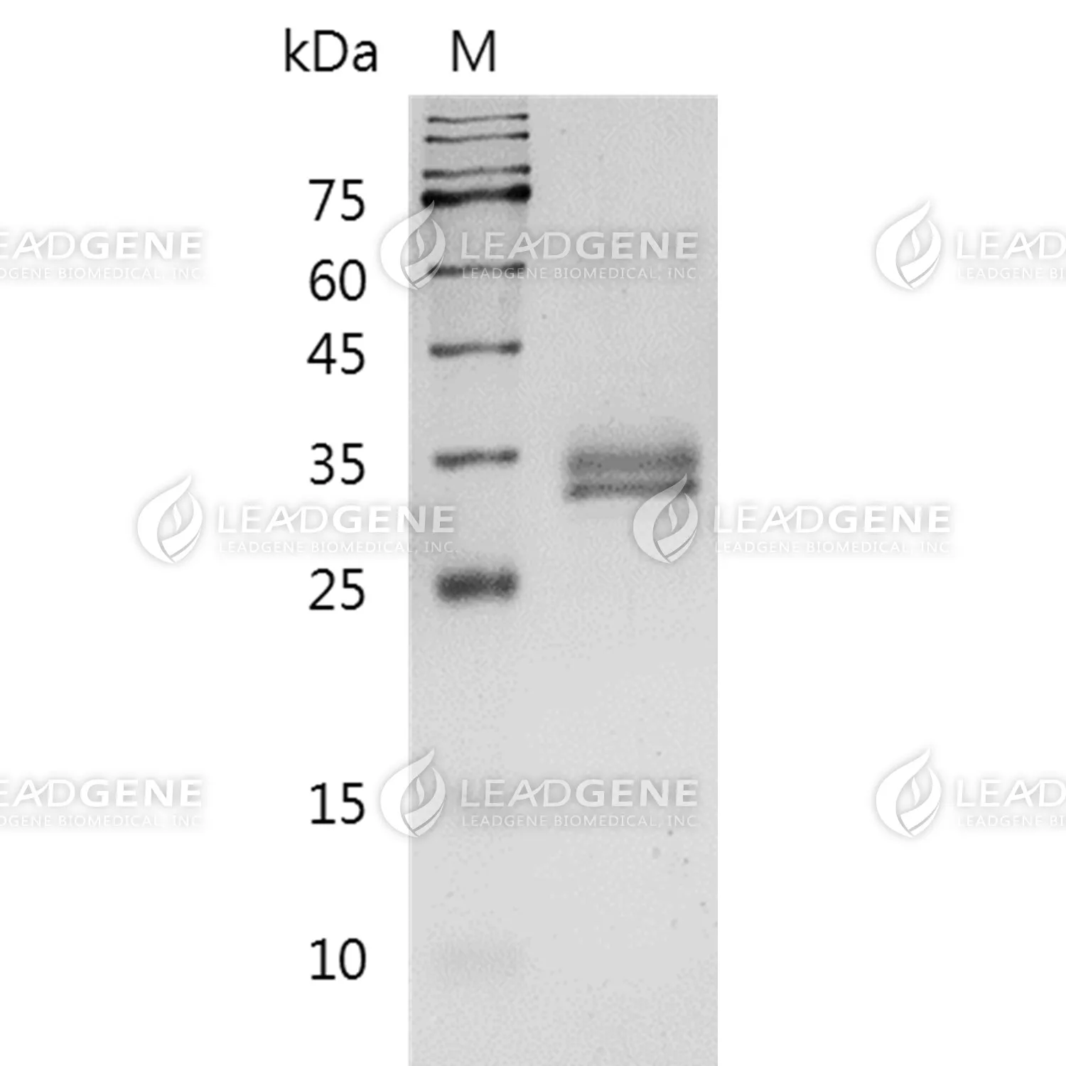 SDS-PAGE analysis of recombinant Human EpCAM.