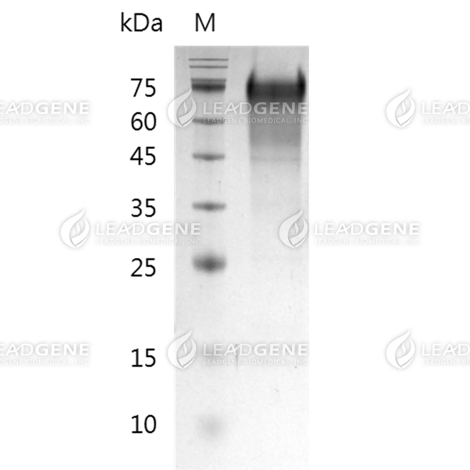 Human CD34, His Tag, HEK293
