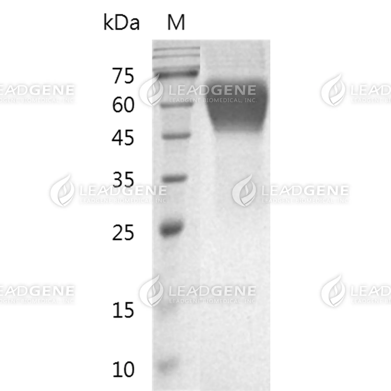 SDS-PAGE analysis of recombinant Human IL-17R.