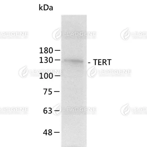 Western blot: TERT transfected 293T cell lysates were stained with mouse anti-TERT monoclonal antibody.