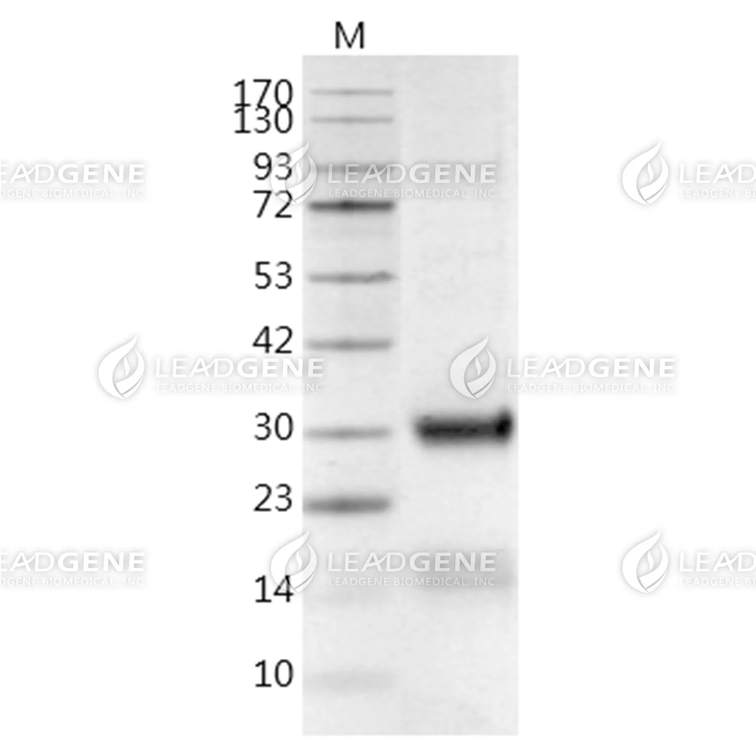 Human FGF-23, His Tag, CHO