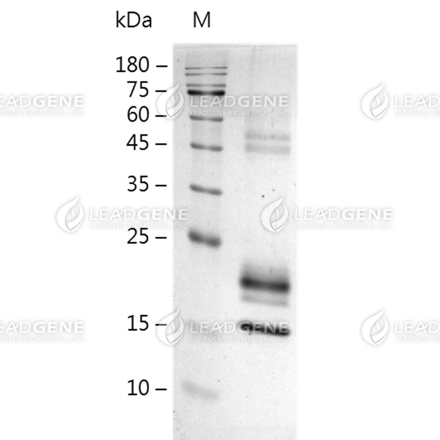 SDS-PAGE analysis of recombinant Mouse IL-10