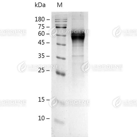 SDS-PAGE analysis of recombinant Human CD116.