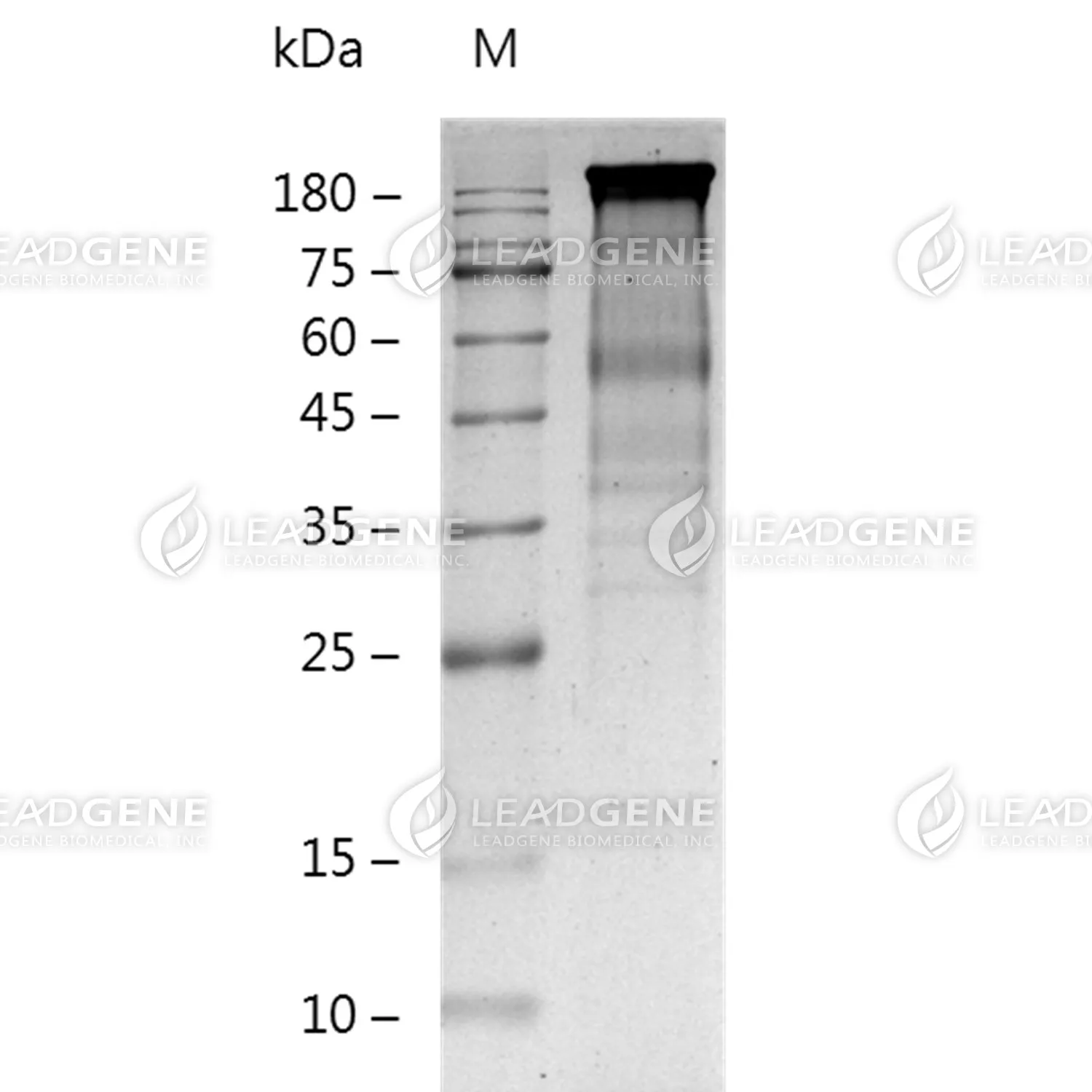 SDS-PAGE analysis of recombinant Mouse CD171.