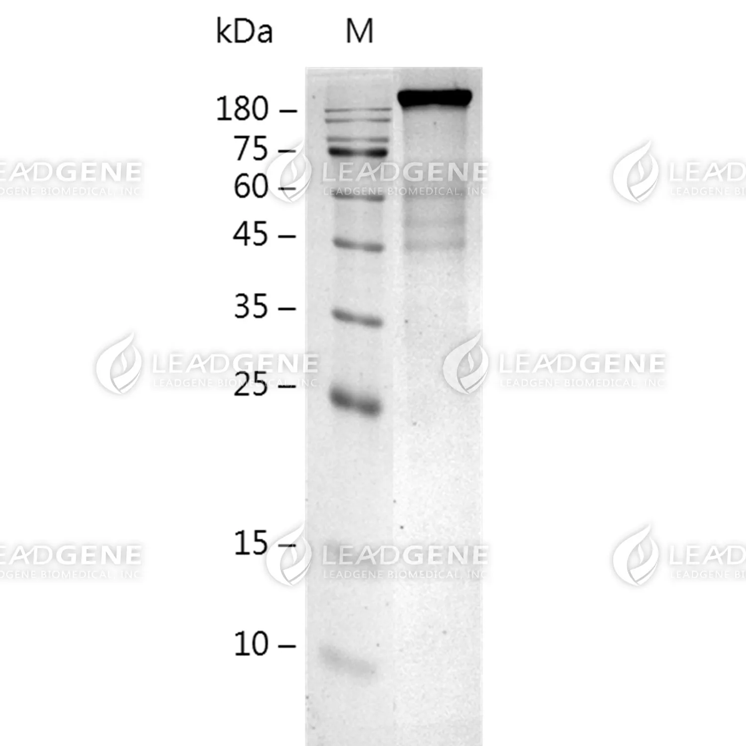SDS-PAGE analysis of recombinant Human CD171.
