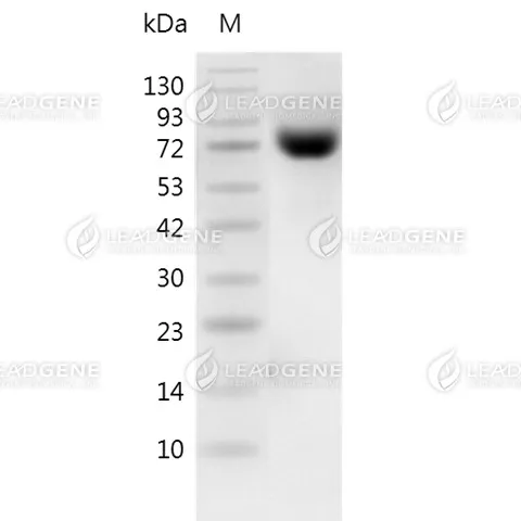 SDS-PAGE analysis of recombinant Human CD56.