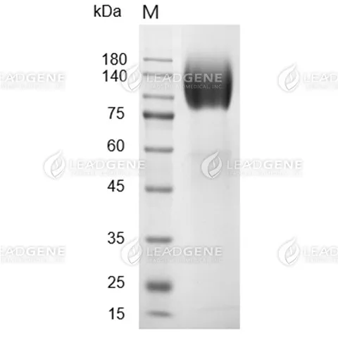 SDS-PAGE analysis of recombinant Human CEACAM5.