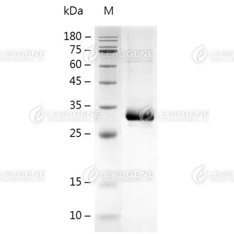 Human MSLN (37-286), His Tag, CHO