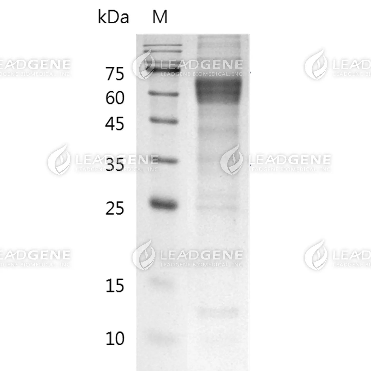 SDS-PAGE analysis of recombinant mouse 5T4.