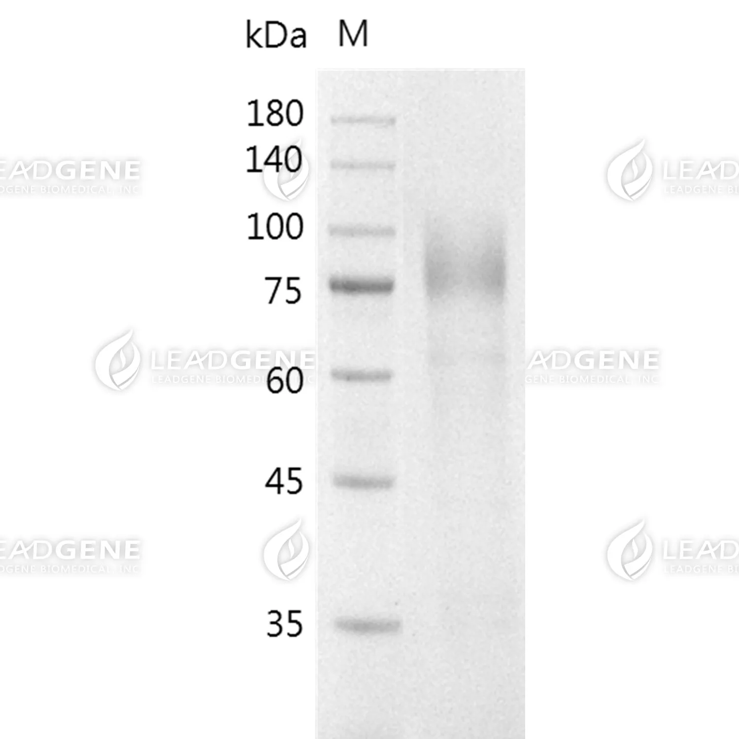Human CD180, His Tag, CHO