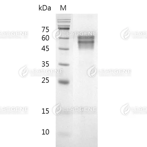 SDS-PAGE analysis of recombinant Mouse IL-15.