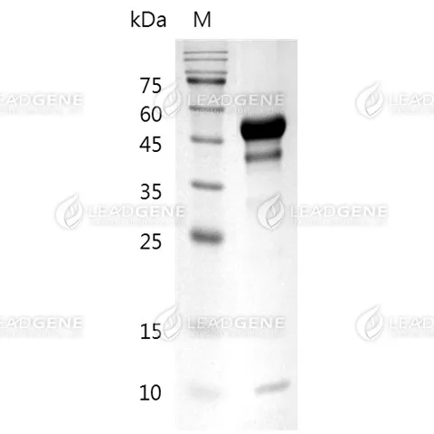 Human CD5, His Tag, CHO