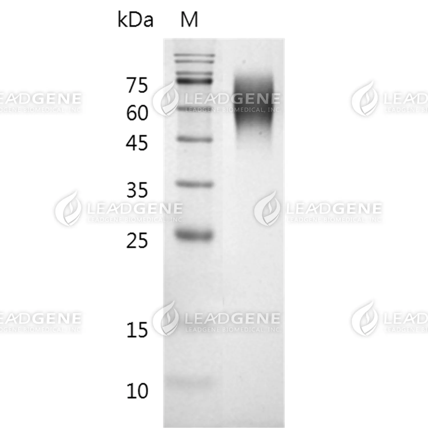 SDS-PAGE analysis of recombinant Mouse SIRP Alpha.
