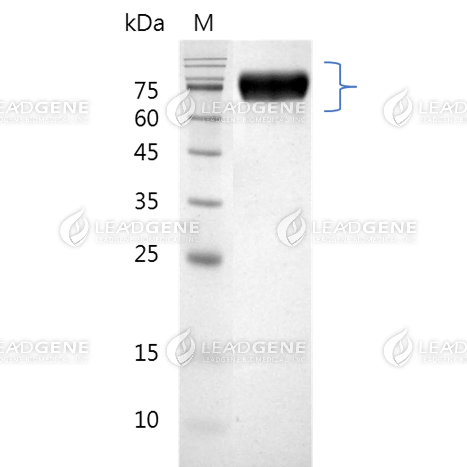SDS-PAGE analysis of recombinant human SIRP Alpha.