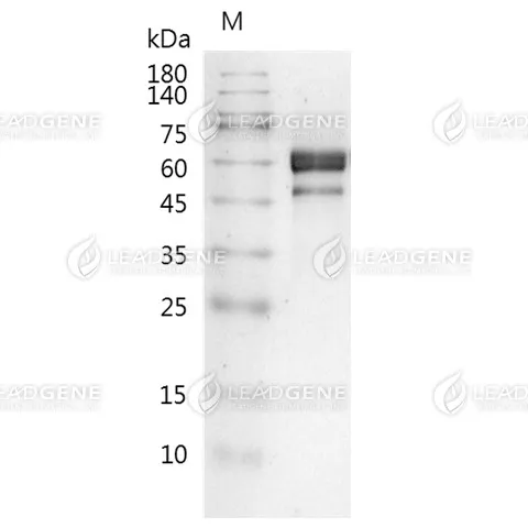 Human DLL3, His Tag, CHO