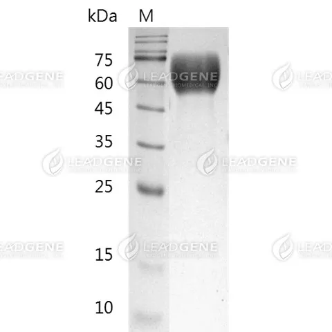 SDS-PAGE analysis of recombinant human FGFR1.