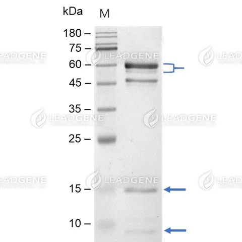 Mouse PCSK9, His Tag, CHO