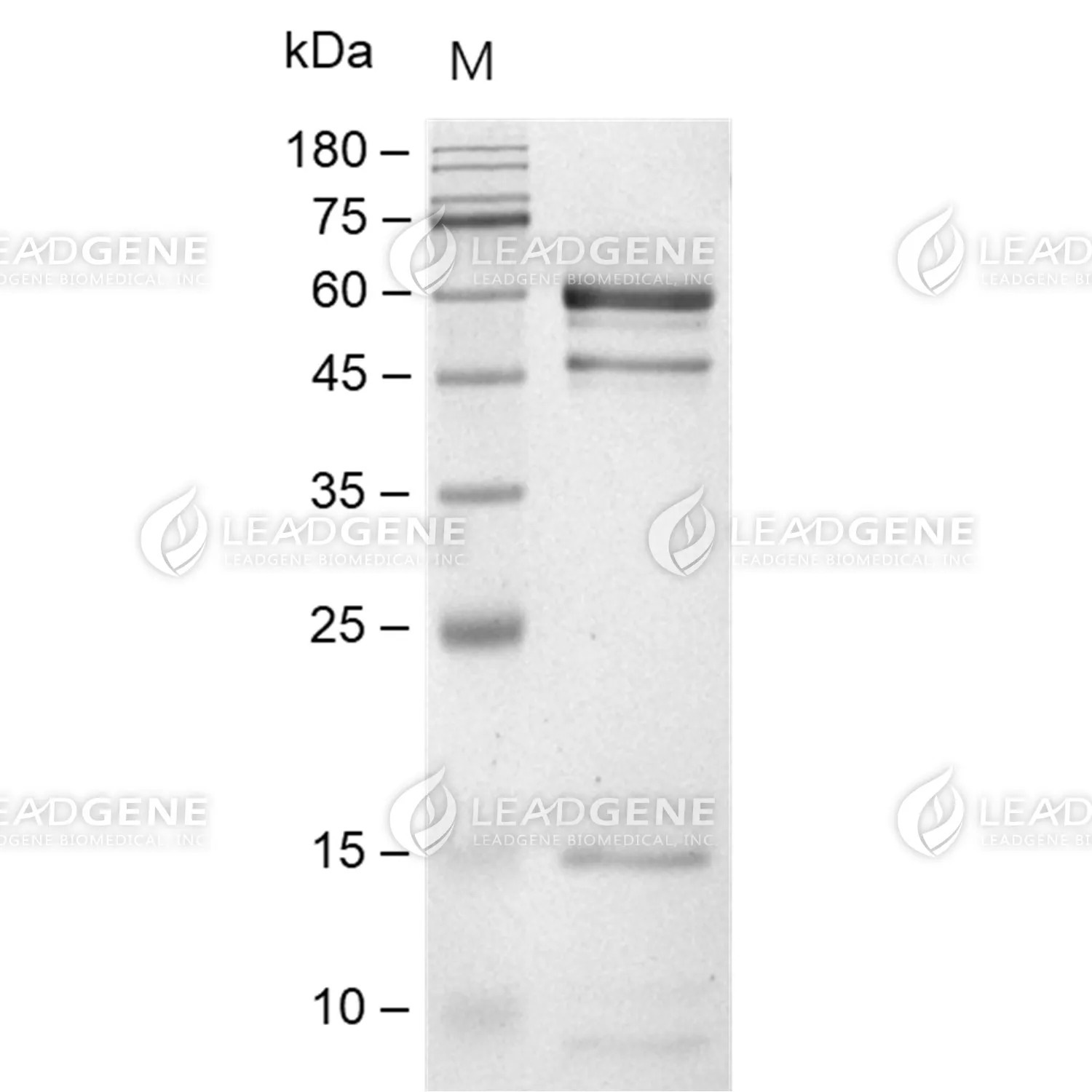 Mouse PCSK9, His Tag, CHO