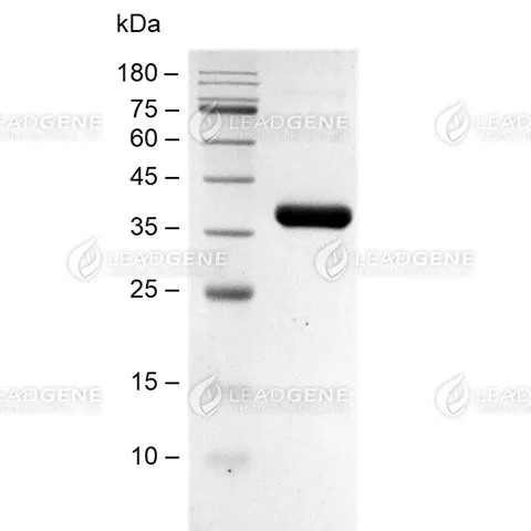 Mouse Endotrophin, Fc Tag, CHO