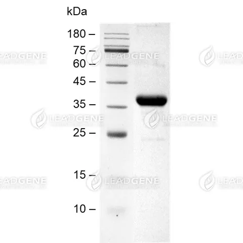 Human Endotrophin, Fc Tag, CHO