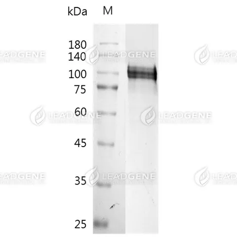 SDS-PAGE analysis of recombinant Human Amyloid beta.