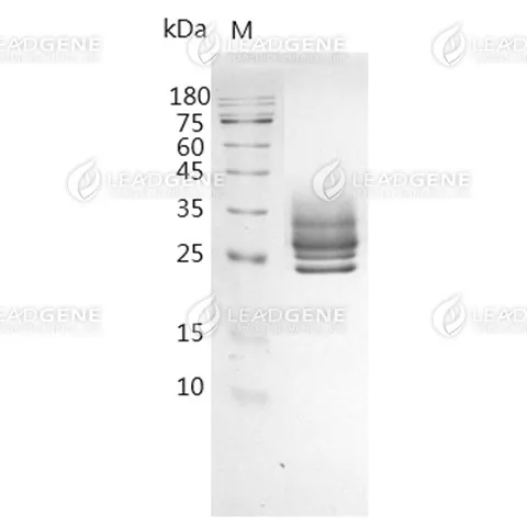 Mouse CD147, His Tag, CHO