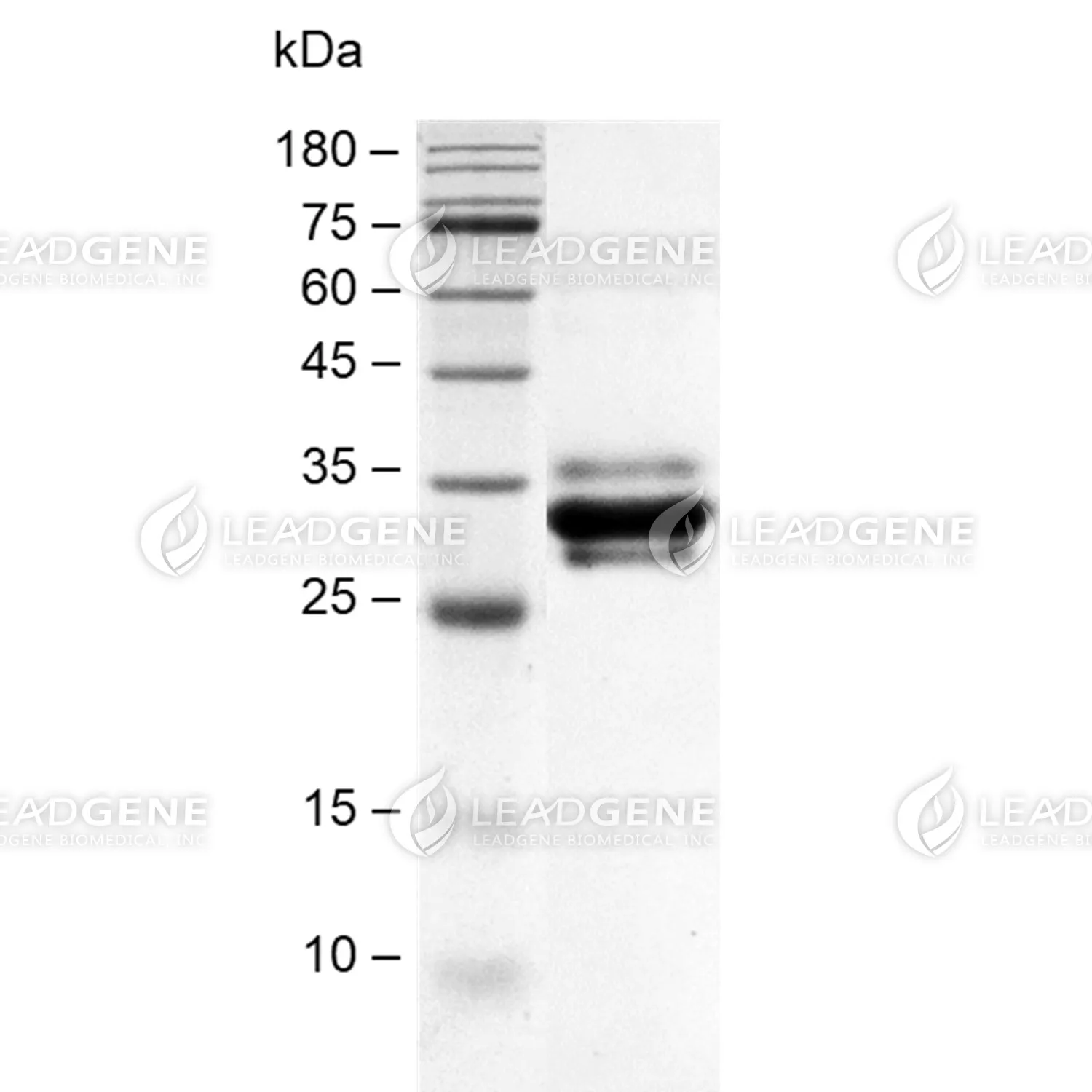 SDS-PAGE analysis of recombinant Human GPA33.