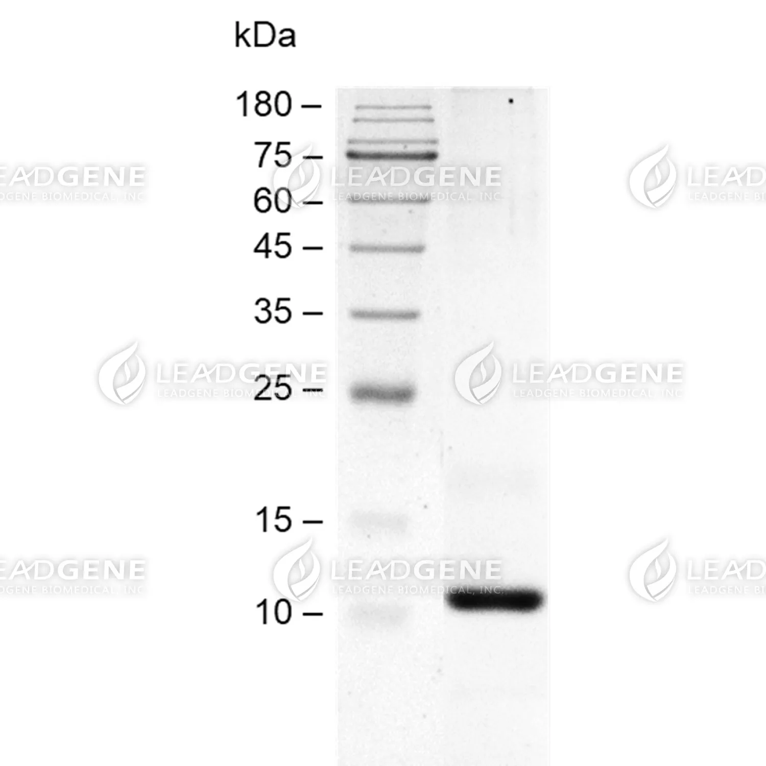 Human Alpha Lactalbumin, His Tag, CHO
