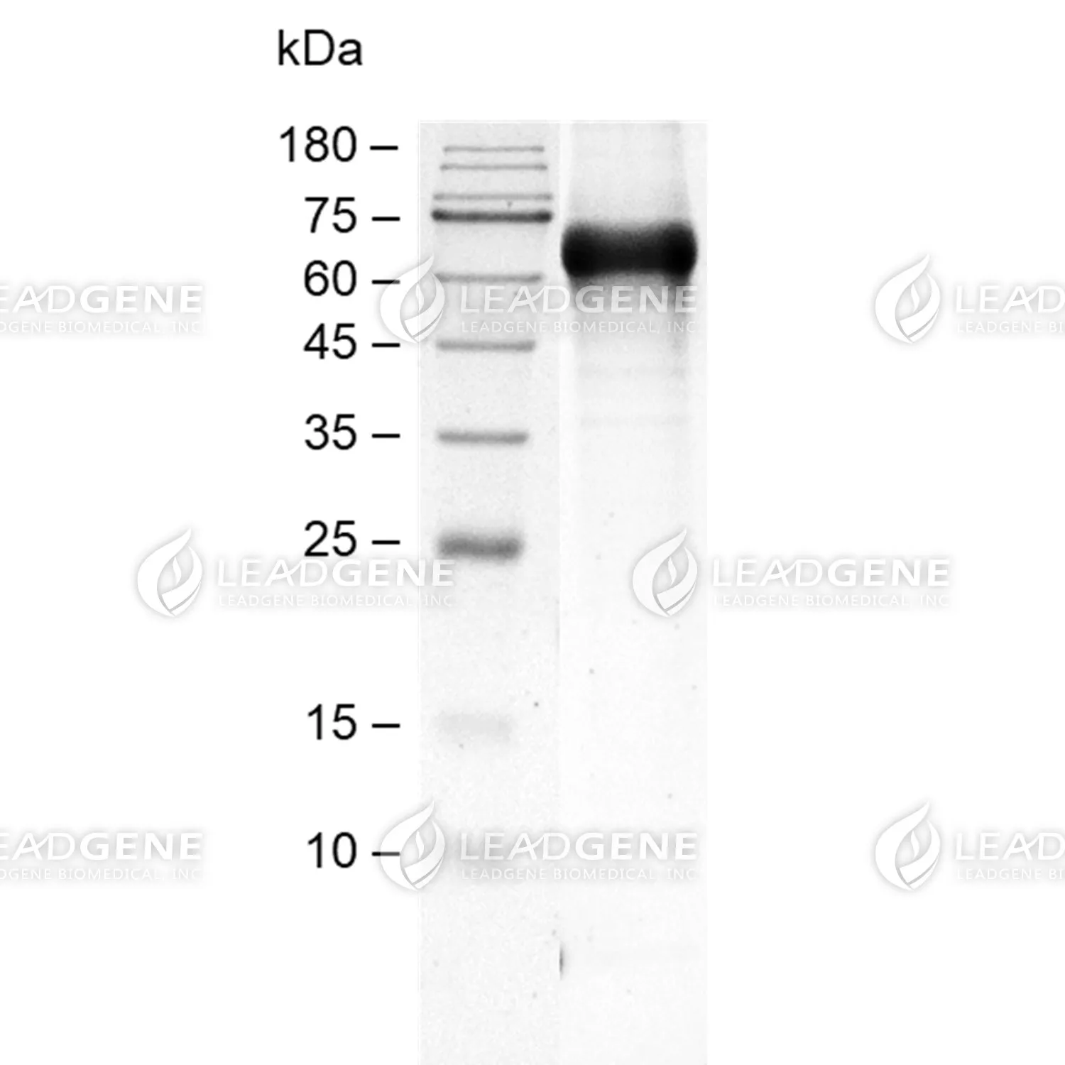 SDS-PAGE analysis of recombinant Mouse FCRL5.