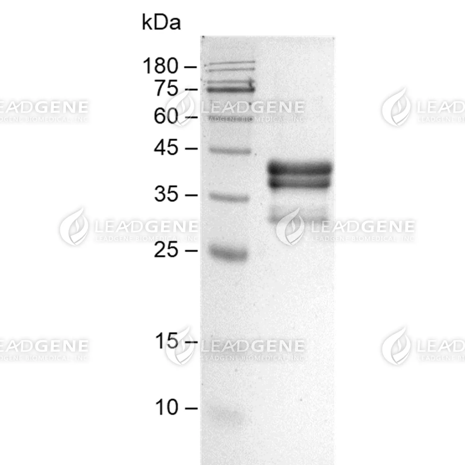 Human Complement C5a, Fc Tag, CHO