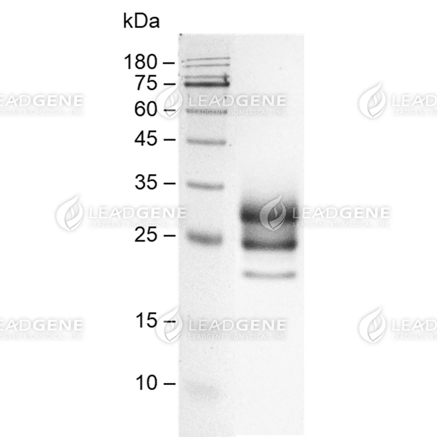 Human CD147, His Tag, CHO