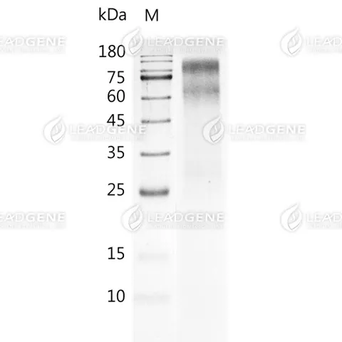 Human CA125, His Tag, CHO