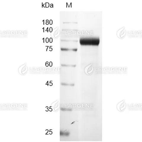 SDS-PAGE analysis of recombinant human CDH17.