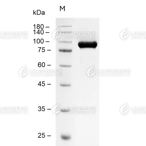Human MMP9, His Tag, CHO