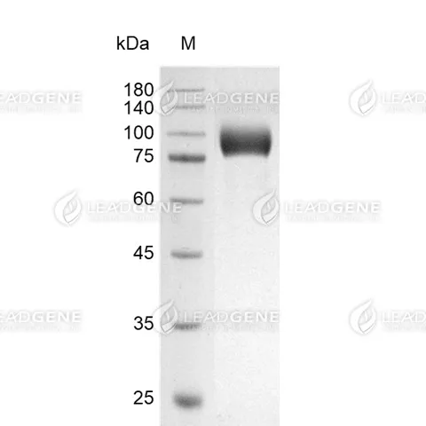 SDS-PAGE analysis of recombinant Human CD10.