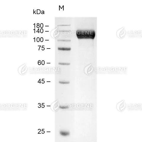 SDS-PAGE analysis of recombinant human ROBO1.